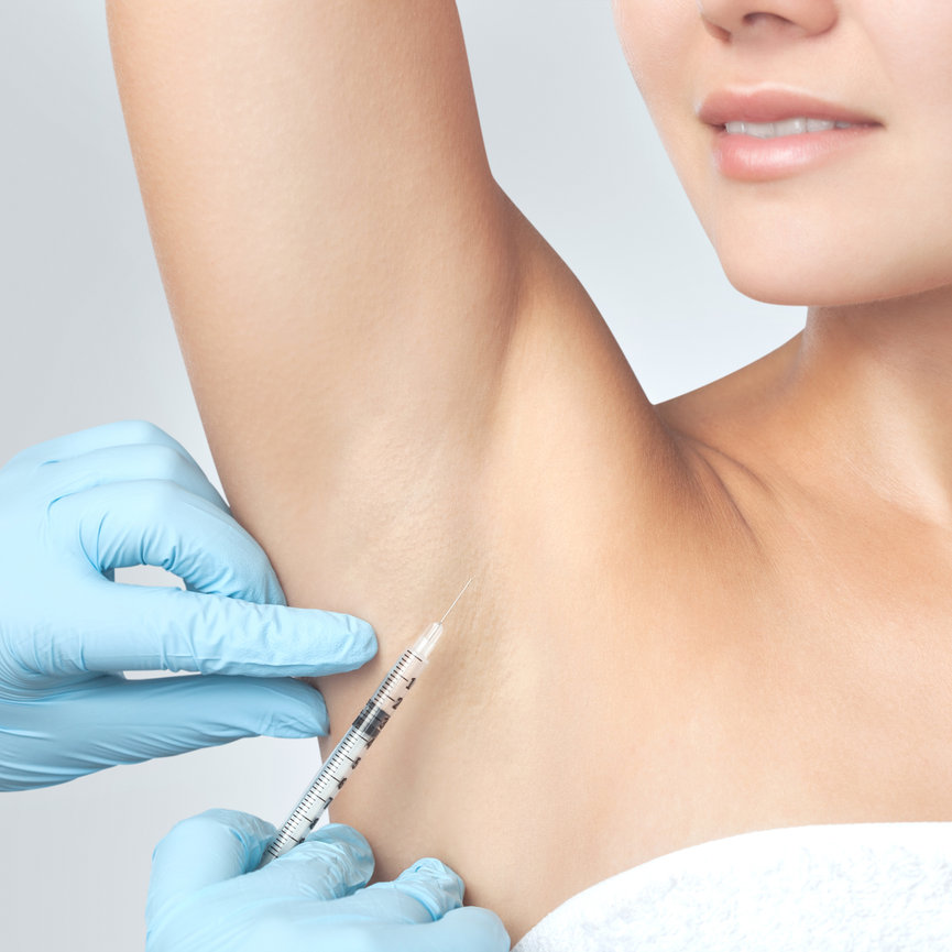 Botox® for excessive sweating in Dallas, Texas