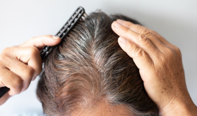 man brushing hair after hair restoration treatment - OMNI SCULPT MD - Dallas, TX