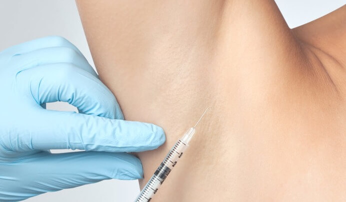 botox injected into the underarm for hyperhidrosis treatment