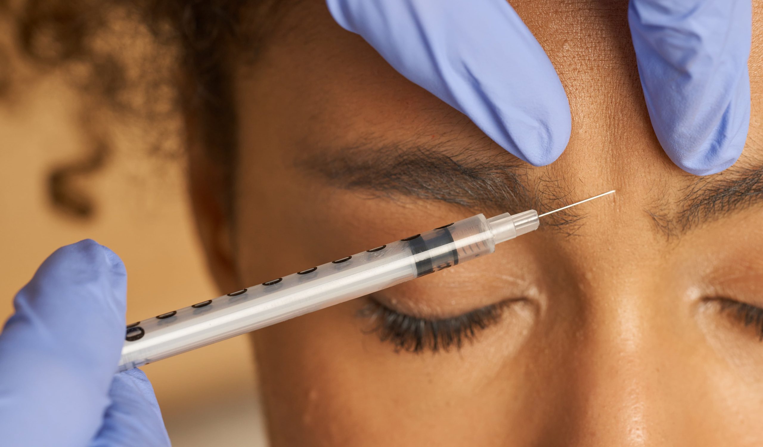 woman getting botox injection between eyebrows - OMNI SCULPT MD - Dallas, TX
