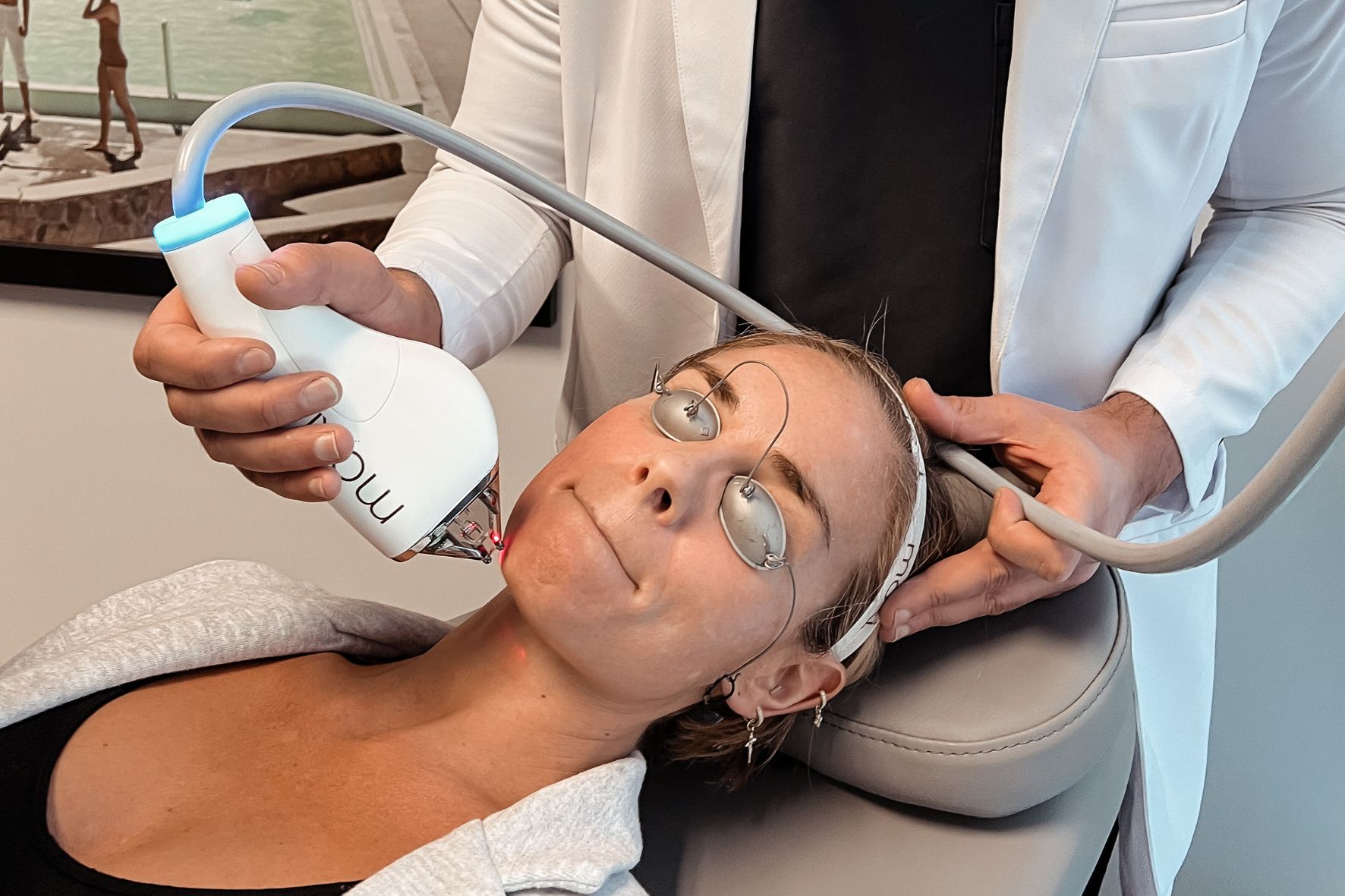 moxi laser for summer skincare treatment at omni sculpt md medspa in dallas, tx