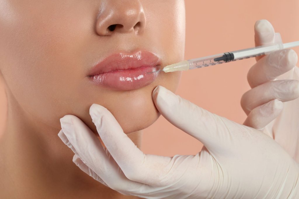 dissolve dermal filler